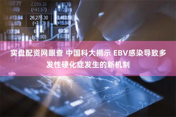 实盘配资网眼查 中国科大揭示 EBV感染导致多发性硬化症发生的新机制